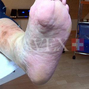 callus_4